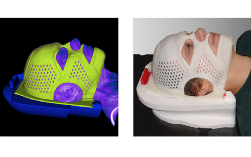 iReal 3D医疗扫描