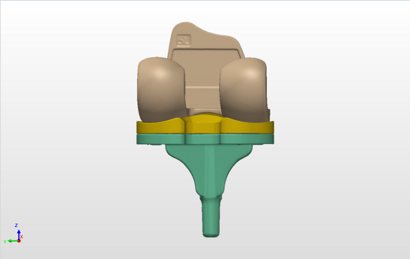 人工膝关节组件3D扫描数据
