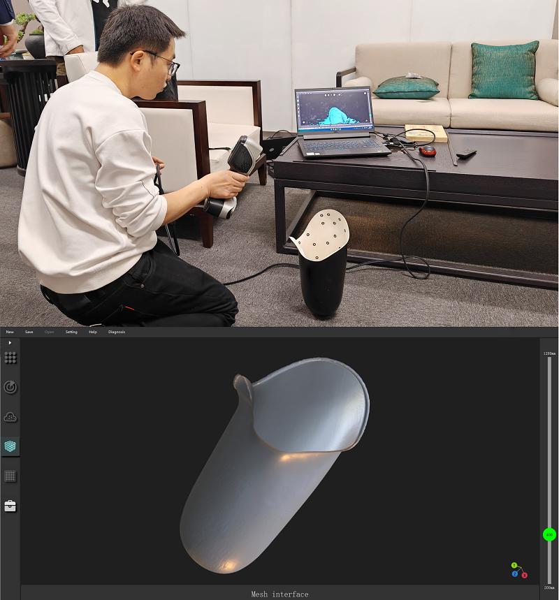假肢接受腔3D扫描
