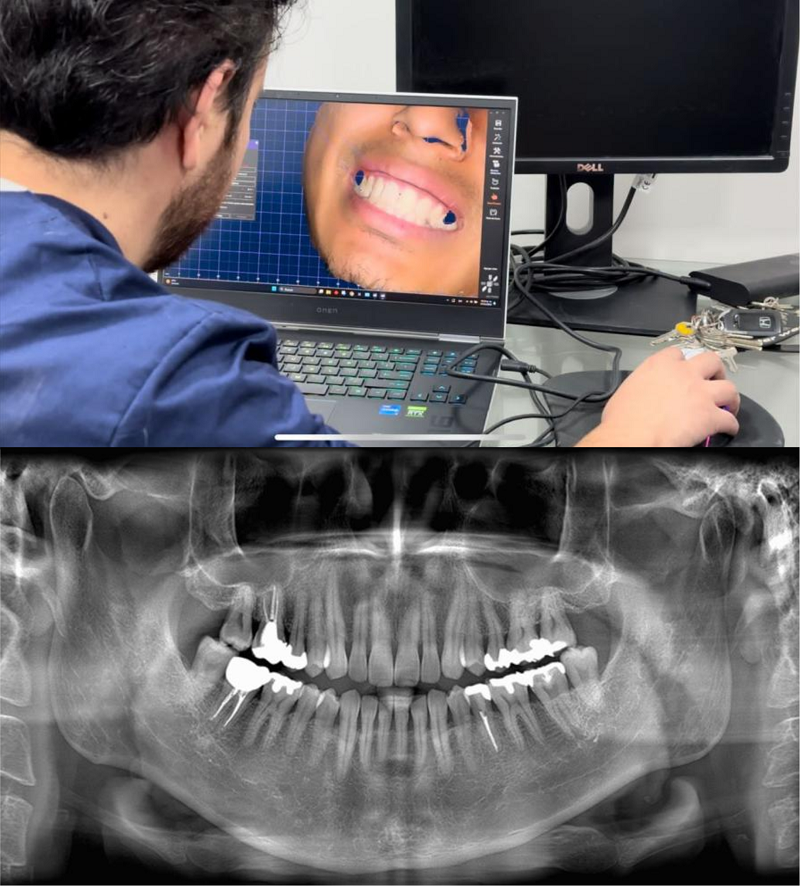 牙齿3D扫描数据